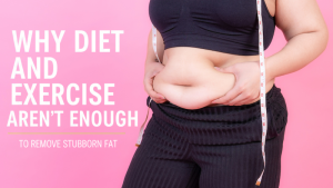 Why Diet and Exercise Aren’t Enough to remove stubborn fat to make body sculpting.