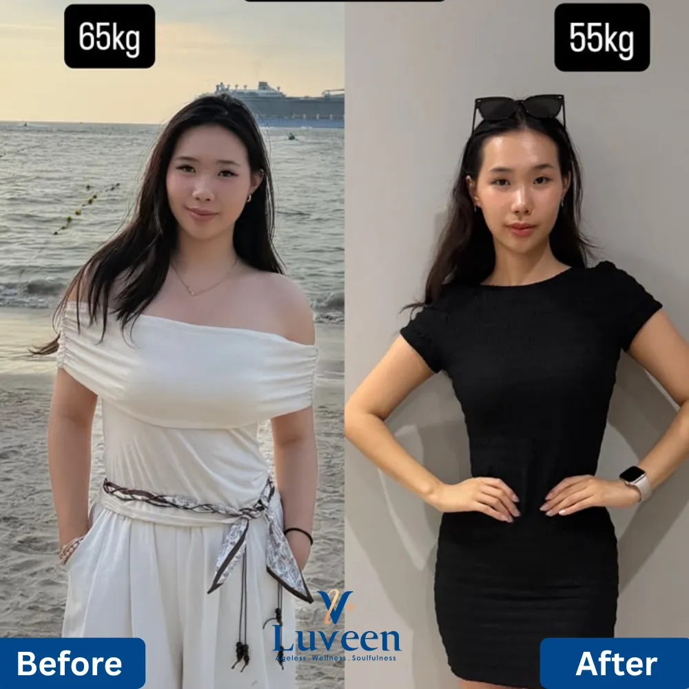 luveen-liposhape-slimming-beforeafter-03
